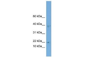 Western Blotting (WB) image for anti-Actin Related Protein 2/3 Complex, Subunit 3, 21kDa (ARPC3) (Middle Region) antibody (ABIN2784769)