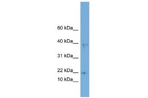 WB Suggested Anti-ARPC3 Antibody Titration: 0. (ARPC3 抗体  (Middle Region))