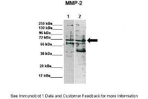 Lanes:   Lane 1: 15ug MDA-MB-231 lysate Lane 2: 15ug MCF7 lysate  Primary Antibody Dilution:    1:1000  Secondary Antibody:   Anti-rabbit-HRP  Secondary Antibody Dilution:    1:10,000  Gene Name:   MMP2  Submitted by:   Katarzyna Augoff, University of Wroclaw (MMP2 抗体  (C-Term))