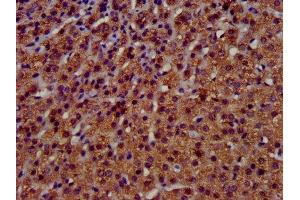 IHC image of ABIN7173123 diluted at 1:400 and staining in paraffin-embedded human adrenal gland tissue performed on a Leica BondTM system. (TMEM192 抗体  (AA 193-271))