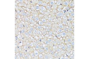 Immunohistochemistry of paraffin-embedded rat liver using CTNN antibody (ABIN7266134) at dilution of 1:100 (40x lens). (CTNNA2 抗体  (AA 150-300))