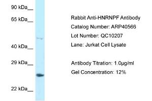 WB Suggested Anti-HNRNPF Antibody   Titration: 1. (HNRNPF 抗体  (C-Term))
