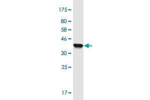 Western Blot detection against Immunogen (36. (MLXIP 抗体  (AA 481-577))