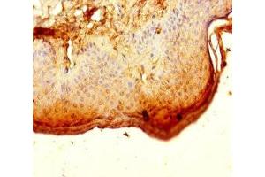 Immunohistochemistry of paraffin-embedded human skin tissue using ABIN7150586 at dilution of 1:100 (ALG12 抗体  (AA 367-422))