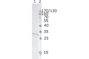 Western Blot testing of HIV-1 recombinant Nef protein. (HIV-1 Nef (AA 31-35) 抗体)