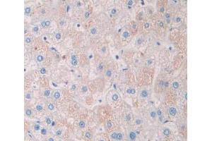 Used in DAB staining on fromalin fixed paraffin- embedded liver tissue (TSTA3 抗体  (AA 1-321))