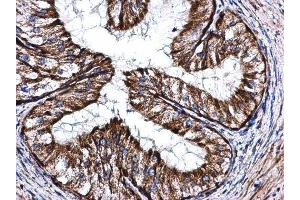 Immunohistochemistry (IHC) image for anti-Cytochrome C Oxidase Subunit Va (COX5A) (Center) antibody (ABIN2855063)