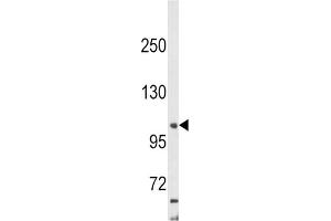 Western Blotting (WB) image for anti-Adaptor-Related Protein Complex 2, alpha 2 Subunit (AP2A2) antibody (ABIN3003799) (AP2A2 抗体)