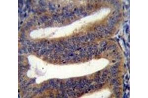RBPMS2 antibody immunohistochemistry analysis in formalin fixed and paraffin embedded human uterus tissue. (RBPMS2 抗体  (AA 113-141))