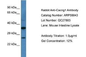 WB Suggested Anti-Cacng1  Antibody Titration: 0. (CACNG1 抗体  (N-Term))