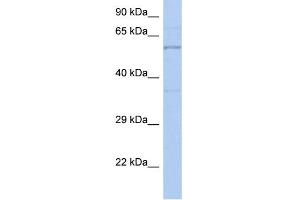 WB Suggested Anti-TH Antibody Titration: 0. (TH 抗体  (N-Term))