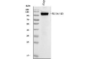 Western blot analysis of SLC4A1 using anti-SLC4A1 antibody (ABIN7601075).