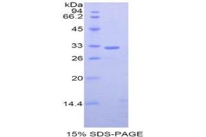 SDS-PAGE analysis of Mouse GRAP2 Protein. (GRAP2 蛋白)
