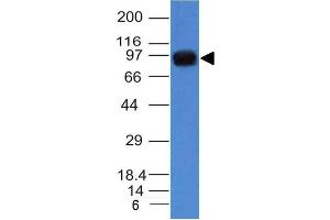 Western Blot of A431 cell lysate using Nucleolin Mouse Monoclonal Antibody (NCL/902). (Nucleolin 抗体)