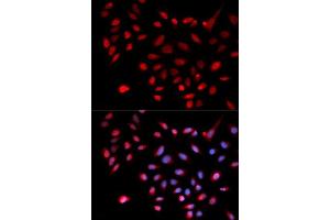 Immunofluorescence (IF) image for anti-Cyclin-Dependent Kinase 9 (CDK9) (AA 153-372) antibody (ABIN3015519)