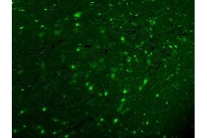 IF analysis of Calbindin using anti-Calbindin antibody (ABIN6719541). (CALB1 抗体  (AA 2-261))