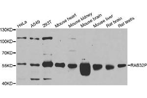 Western blot analysis of extracts of various cell lines, using RAB3IP antibody. (RAB3IP 抗体)