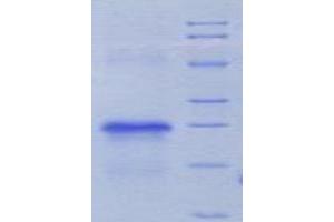 SDS-PAGE (SDS) image for Plasminogen Activator, Urokinase Receptor (PLAUR) (AA 17-212) protein (His tag) (ABIN1080532)