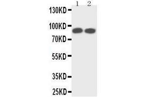 Western Blotting (WB) image for anti-Neurotrophic Tyrosine Kinase, Receptor, Type 1 (NTRK1) (AA 71-90), (N-Term) antibody (ABIN3042872)