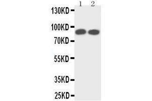Anti-TrkA antibody,  Western blotting Lane 1: Rat Brain Tissue Lysate Lane 2: Mouse Brain Tissue Lysate