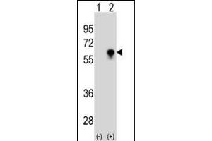 Western blot analysis of CDC25C (arrow) using CDC25C Antibody (ABIN1539792 and ABIN2843765). (CDC25C 抗体)