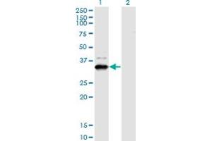 Western Blot analysis of ZNF365 expression in transfected 293T cell line by ZNF365 monoclonal antibody (M03), clone 2E3. (ZNF365 抗体  (AA 147-219))