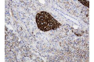 Image no. 1 for anti-CD99 (CD99) antibody (ABIN1497383) (CD99 抗体)
