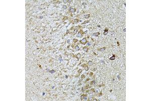 Immunohistochemistry of paraffin-embedded Rat brain using MTNR1A antibody (ABIN6128254, ABIN6144165, ABIN6144166 and ABIN6216865) at dilution of 1:100 (40x lens). (Melatonin Receptor 1A 抗体  (AA 281-350))