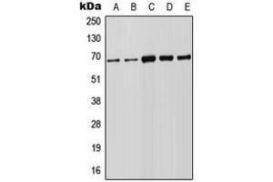 Western blot analysis of FOXN1 expression in Raji (A), HeLa (B), A549 (C), NIH3T3 (D), PC12 (E) whole cell lysates. (FOXN1 抗体  (Center))