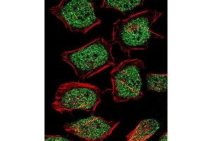 Fluorescent confocal image of Hela cell stained with NR3C1 Antibody (Center) (ABIN651659 and ABIN2840347). (Glucocorticoid Receptor 抗体  (AA 236-262))