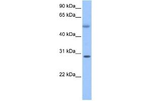 C17ORF81 antibody used at 1 ug/ml to detect target protein. (Retinoic Acid Induced 12 (RAI12) (C-Term) 抗体)