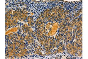 ABIN6261604 and ABIN6266802 at 1/100 staining Rat ovarian tissue by IHC-P. (EPS8-Like 2 抗体  (N-Term))