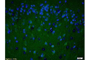 Formalin-fixed and paraffin embedded rat brain labeled with Anti PARP (N-Terminus) Polyclonal Antibody, Unconjugated (ABIN677903) at 1:200 followed by conjugation to the secondary antibody Goat Anti-Rabbit IgG, FITC conjugated used at 1:200 dilution for 40 minutes at 37°C and DAPI (PARP1 抗体  (AA 201-300))