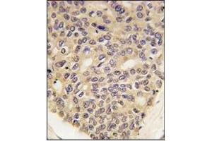 Immunohistochemistry (IHC) image for anti-PTEN Induced Putative Kinase 1 (PINK1) antibody (ABIN356391) (PINK1 抗体)