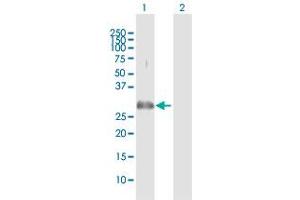 Western Blot analysis of PLSCR3 expression in transfected 293T cell line by PLSCR3 MaxPab polyclonal antibody. (PLSCR3 抗体  (AA 1-295))
