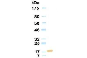Western Blotting (WB) image for anti-Collagen, Type XVIII, alpha 1 (COL18A1) antibody (ABIN933868)