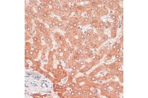 Immunohistochemistry of paraffin-embedded human liver using  antibody (ABIN6131192, ABIN6137264, ABIN6137265 and ABIN6215207) at dilution of 1:100 (40x lens). (ATG5 抗体  (AA 28-275))