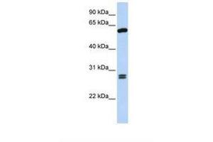 Image no. 1 for anti-Adrenocortical Dysplasia Homolog (ACD) (AA 398-447) antibody (ABIN6739073)