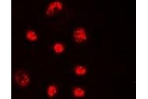Immunofluorescent analysis of Lupus La (pS366) staining in HeLa cells. (Lupus La (C-Term), (pSer366) 抗体)