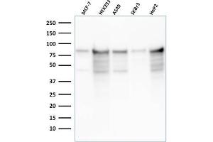 Western Blot Analysis of MCF-7, HEK-293, A549, SKBr3, HeP2 cell lysates using MCM7 Recombinant Mouse Monoclonal Antibody (rMCM7/1468). (Recombinant MCM7 抗体  (AA 195-319))