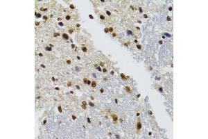 Immunohistochemistry of paraffin-embedded mouse brain using BAZ1B antibody. (BAZ1B 抗体)