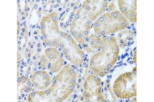 Immunohistochemistry of paraffin-embedded Mouse kidney using HDAC6 Polyclonal Antibody at dilution of 1:100 (40x lens). (HDAC6 抗体)
