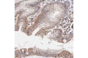 Immunohistochemical staining (Formalin-fixed paraffin-embedded sections) of human stomach with ARHGEF6 polyclonal antibody  shows cytoplasmic and membranous positivity in glandular cells. (ARHGEF6 抗体)