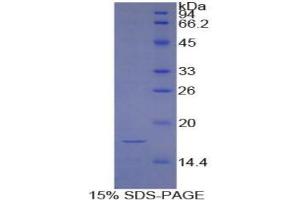 SDS-PAGE (SDS) image for Hypoxia Inducible Factor 1, alpha Subunit (Basic Helix-Loop-Helix Transcription Factor) (HIF1A) protein (ABIN3009909)