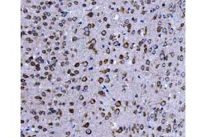 IHC analysis of EIF3A using anti-EIF3A antibody (ABIN7599942). (EIF3A 抗体  (AA 13-477))