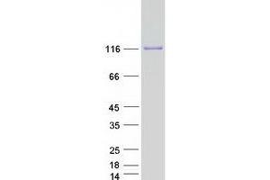 Western Blotting (WB) image for Ring Finger and CCCH-Type Domains 1 (RC3H1) protein (Myc-DYKDDDDK Tag) (ABIN2730649)