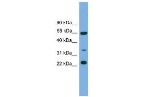 Western Blot showing TRAPPC5 antibody used at a concentration of 1-2 ug/ml to detect its target protein. (TRAPPC5 抗体  (N-Term))