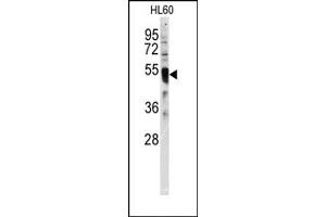 Image no. 1 for anti-Interferon Regulatory Factor 8 (IRF8) (C-Term) antibody (ABIN357999) (IRF8 抗体  (C-Term))