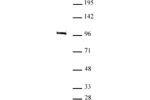 MED15 antibody (pAb) tested by Western blot. (MED15 抗体  (C-Term))