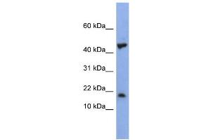 WB Suggested Anti-LSM1 Antibody Titration:  0. (LSM1 抗体  (Middle Region))